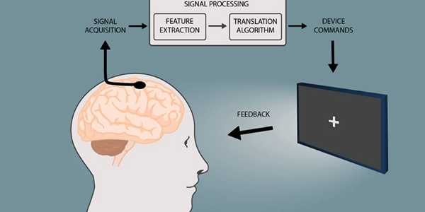 How Brain-Computer Interfaces Are Changing Neurology?